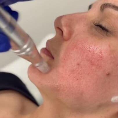 Corrective Glow Series at Bella Glow Skin and Body in San Antonio, TX